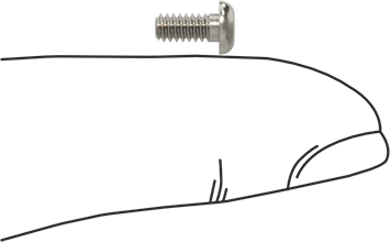 Image of Product. Side1 orientation. Contains SizingReference. High-Strength A286 Stainless Steel Button Head Torx Screw, 4-40 Thread, 1/4" Long.