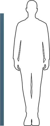 Image of Product. Side1 orientation. Contains SizingReference. Glass-Filled Slippery UHMW Polyethylene, Abrasion-Resistant, 1/4" Thick, 2" Wide, 5 Feet Long.