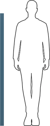Image of Product. Side1 orientation. Contains SizingReference. Glass-Filled Slippery UHMW Polyethylene, Abrasion-Resistant, 3/4" Thick, 2" Wide, 5 Feet Long.